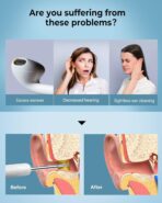 BEBIRD R1 Ear Wax Remover Tool Zinc Alloy Spoon with Food Grade Silicone Cover IP67 Waterproof 10MP Distortion Free Autoscope Camera Visual Ear Cleaner for Men and Women - Image 2